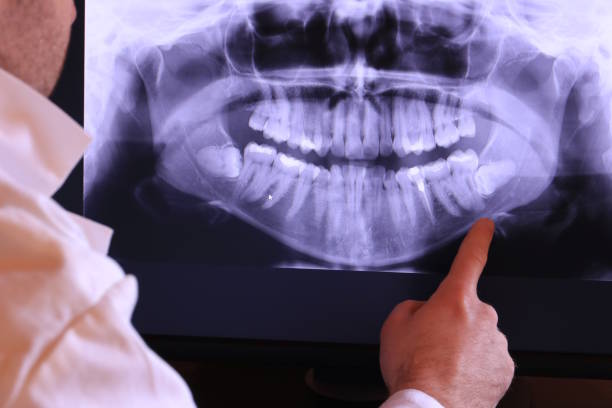 Best Emergency Treatment for Dental Infections or Abscesses in Kihei, HI